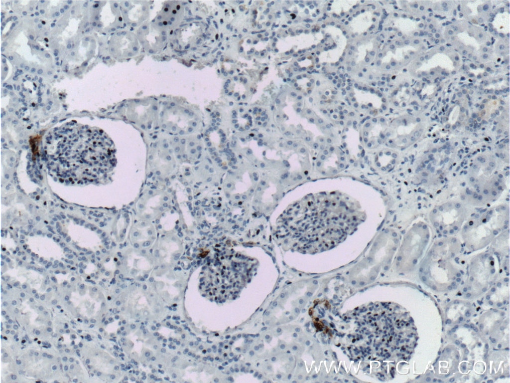 Immunohistochemistry (IHC) staining of human kidney tissue using Renin Polyclonal antibody (14291-1-AP)