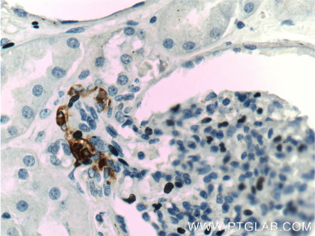 Immunohistochemistry (IHC) staining of human kidney tissue using Renin Polyclonal antibody (14291-1-AP)