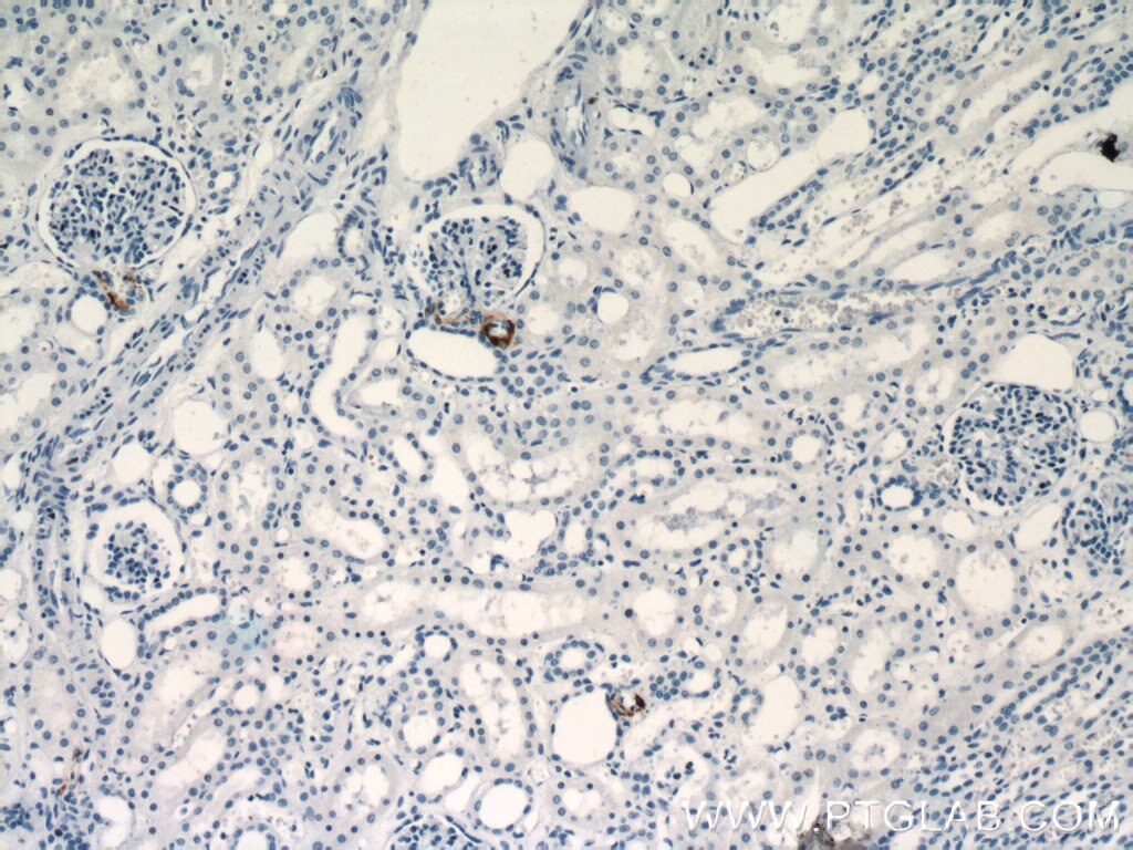 Immunohistochemistry (IHC) staining of human kidney tissue using Renin Polyclonal antibody (14291-1-AP)