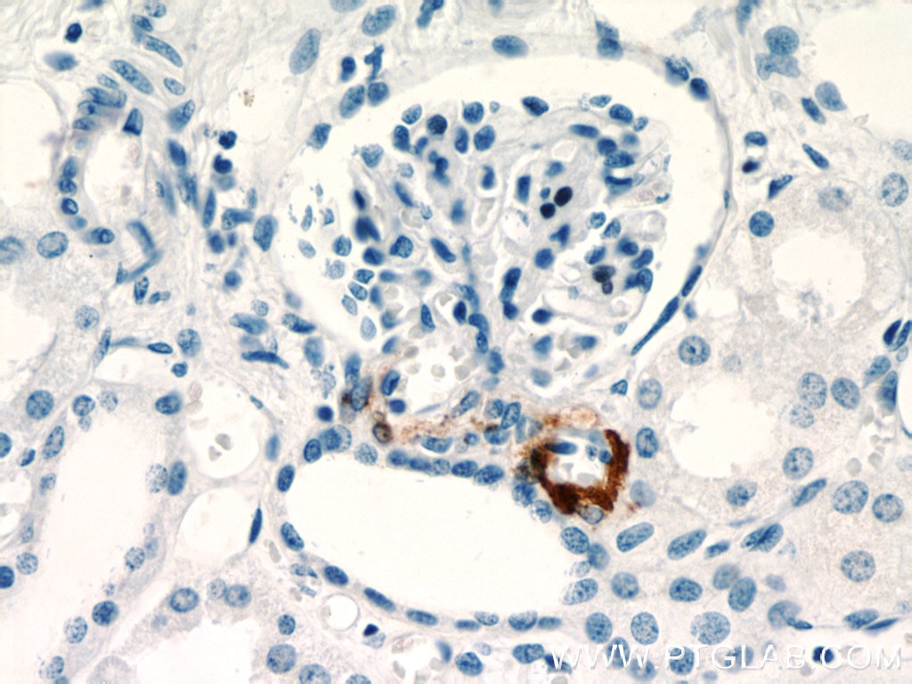 Immunohistochemistry (IHC) staining of human kidney tissue using Renin Polyclonal antibody (14291-1-AP)