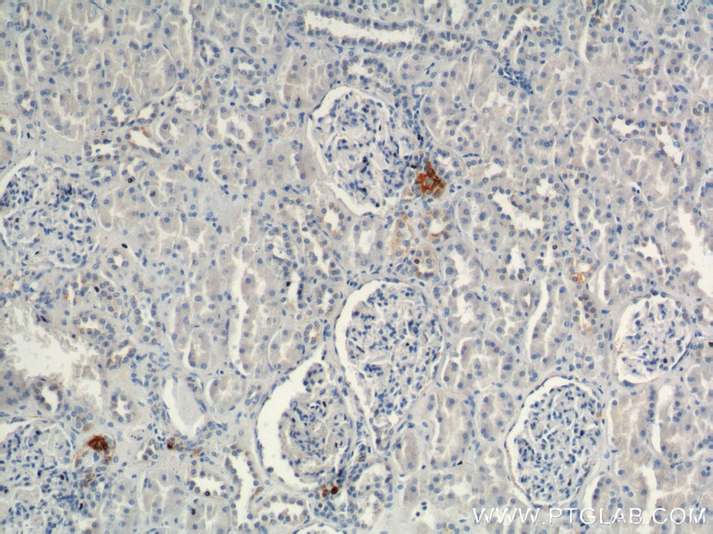IHC staining of human kidney using 14291-1-AP