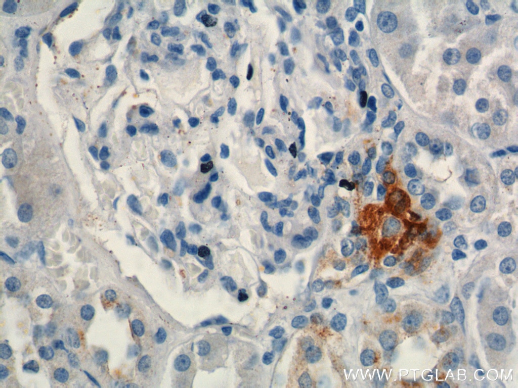 Immunohistochemistry (IHC) staining of human kidney tissue using Renin Polyclonal antibody (14291-1-AP)
