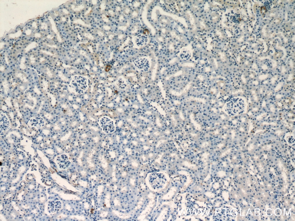 Immunohistochemistry (IHC) staining of mouse kidney tissue using Renin Polyclonal antibody (14291-1-AP)