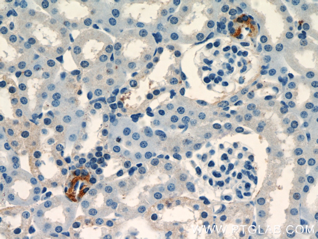 Immunohistochemistry (IHC) staining of mouse kidney tissue using Renin Polyclonal antibody (14291-1-AP)