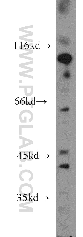 Western Blot (WB) analysis of mouse heart tissue using Renin Polyclonal antibody (14291-1-AP)