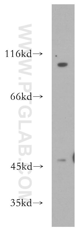 Western Blot (WB) analysis of mouse heart tissue using Renin Polyclonal antibody (14291-1-AP)