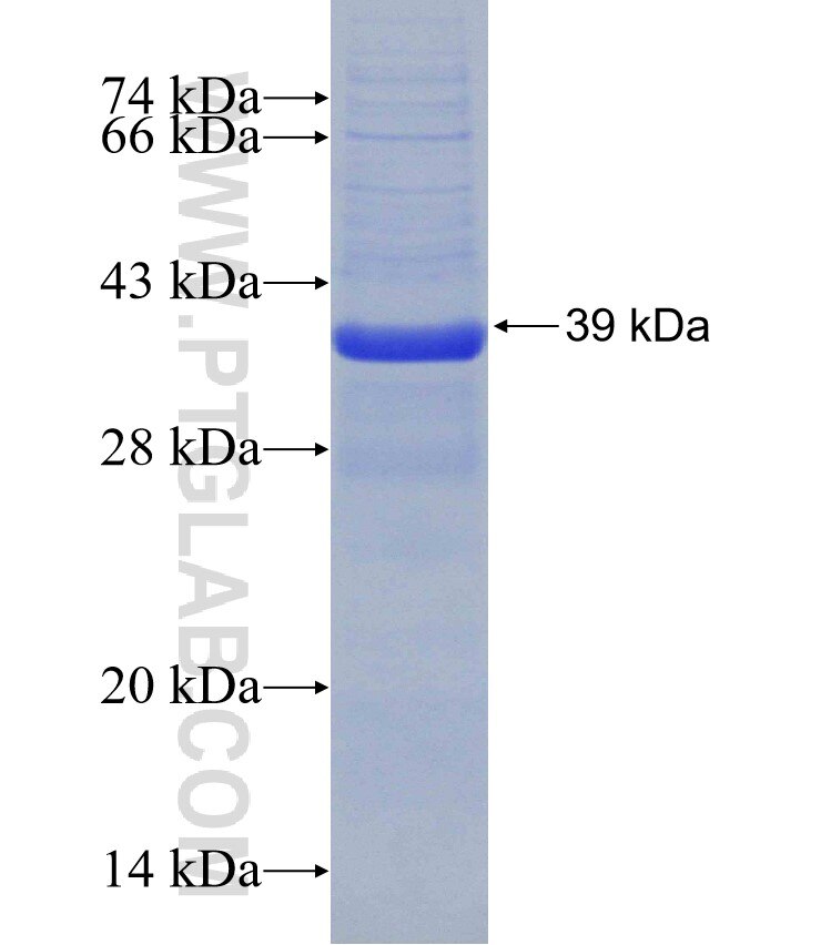 REN fusion protein Ag31071 SDS-PAGE