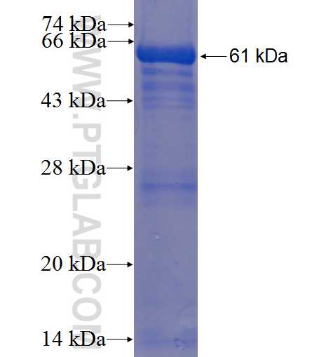 REN fusion protein Ag5612 SDS-PAGE