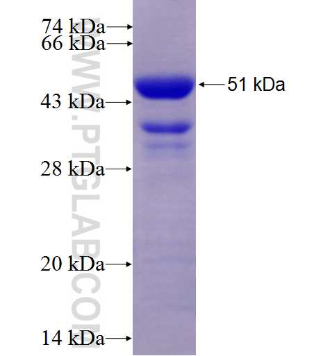 REN fusion protein Ag6173 SDS-PAGE