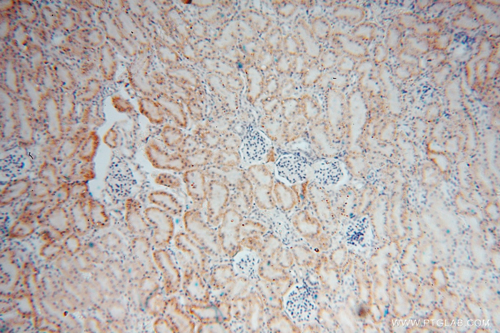 Immunohistochemistry (IHC) staining of human kidney tissue using RENALASE Polyclonal antibody (15003-1-AP)