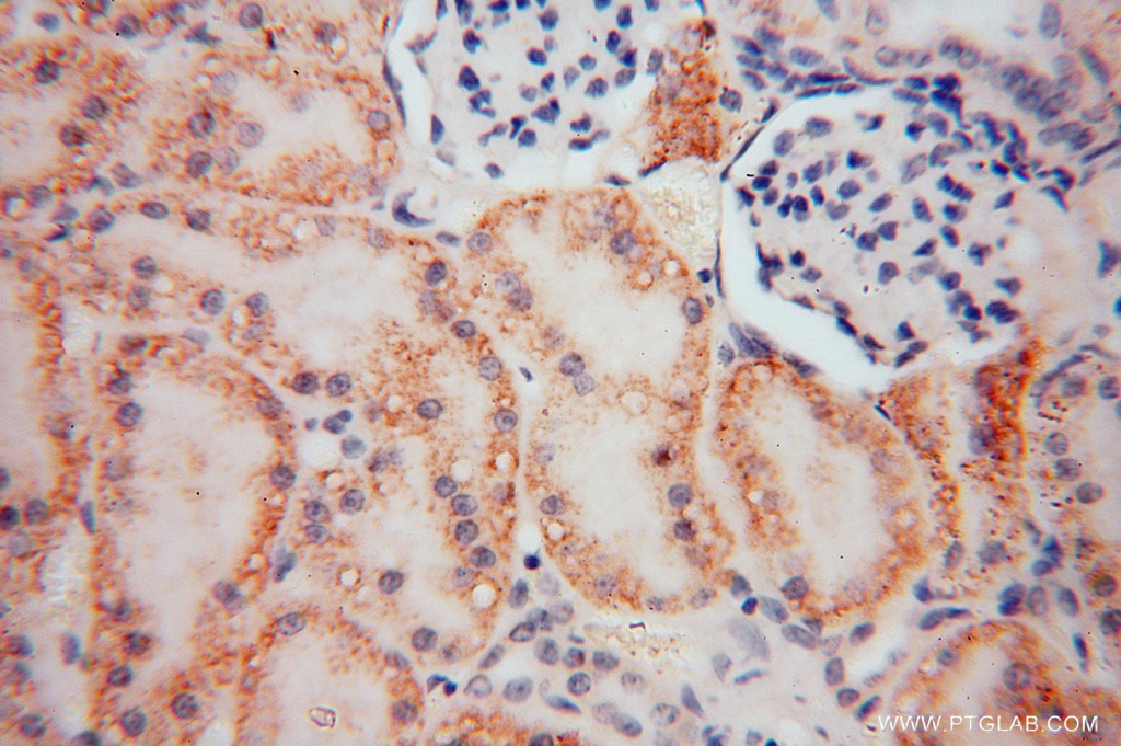 Immunohistochemistry (IHC) staining of human kidney tissue using RENALASE Polyclonal antibody (15003-1-AP)
