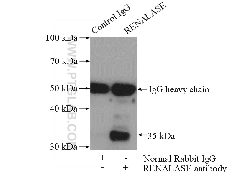 Immunoprecipitation (IP) experiment of HEK-293 cells using RENALASE Polyclonal antibody (15003-1-AP)