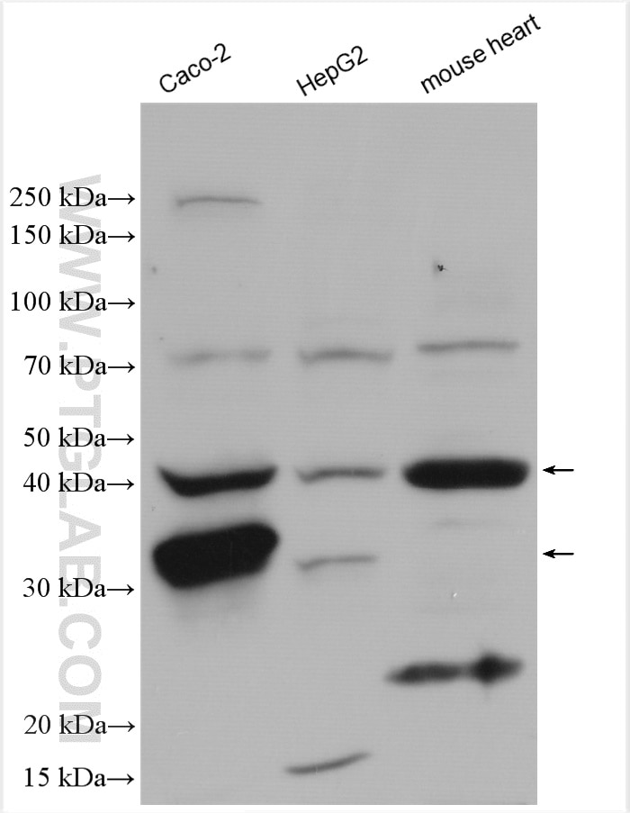 Western Blot (WB) analysis of various lysates using RENALASE Polyclonal antibody (15003-1-AP)