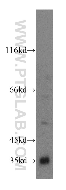 RENALASE