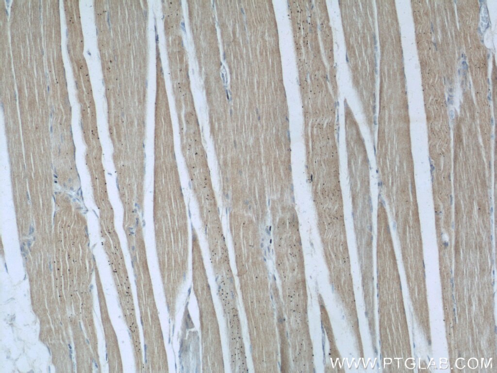 IHC staining of human skeletal muscle using 60128-1-Ig