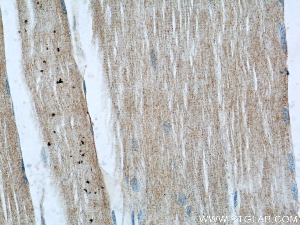 Immunohistochemistry (IHC) staining of human skeletal muscle tissue using RENALASE Monoclonal antibody (60128-1-Ig)