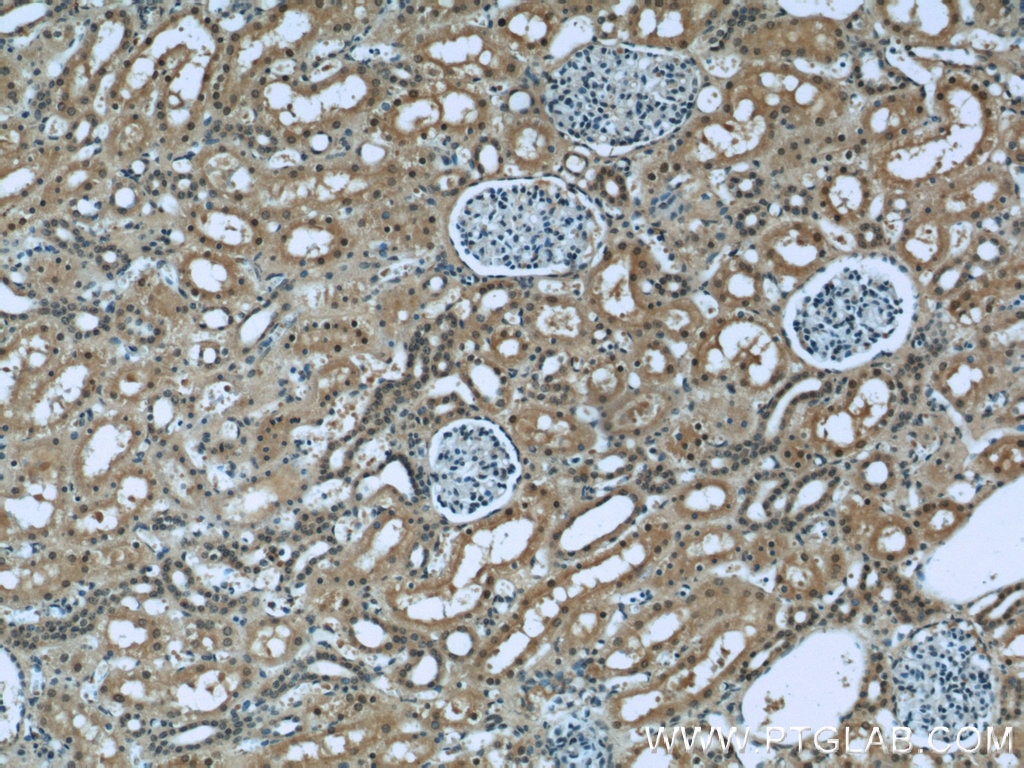 Immunohistochemistry (IHC) staining of human kidney tissue using RENALASE Monoclonal antibody (60128-1-Ig)