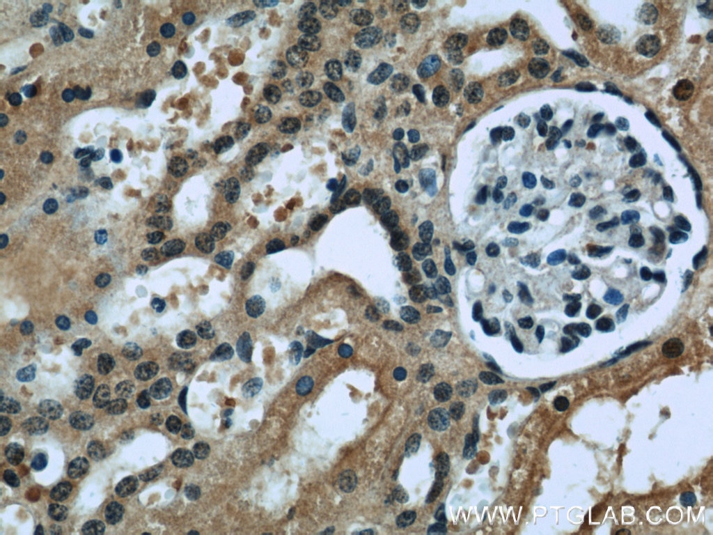 Immunohistochemistry (IHC) staining of human kidney tissue using RENALASE Monoclonal antibody (60128-1-Ig)