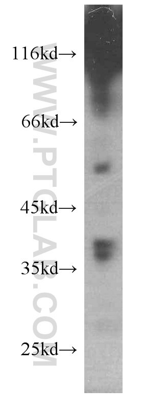 RENALASE