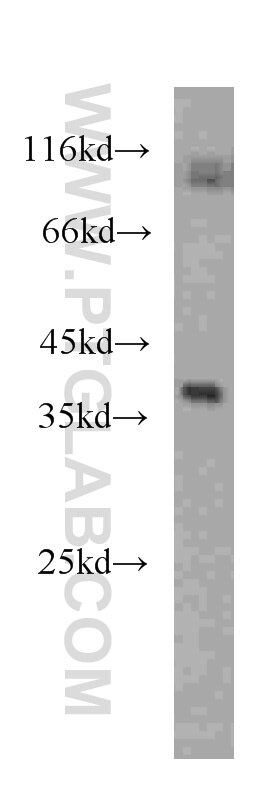 Western Blot (WB) analysis of human heart tissue using RENALASE Monoclonal antibody (60128-1-Ig)