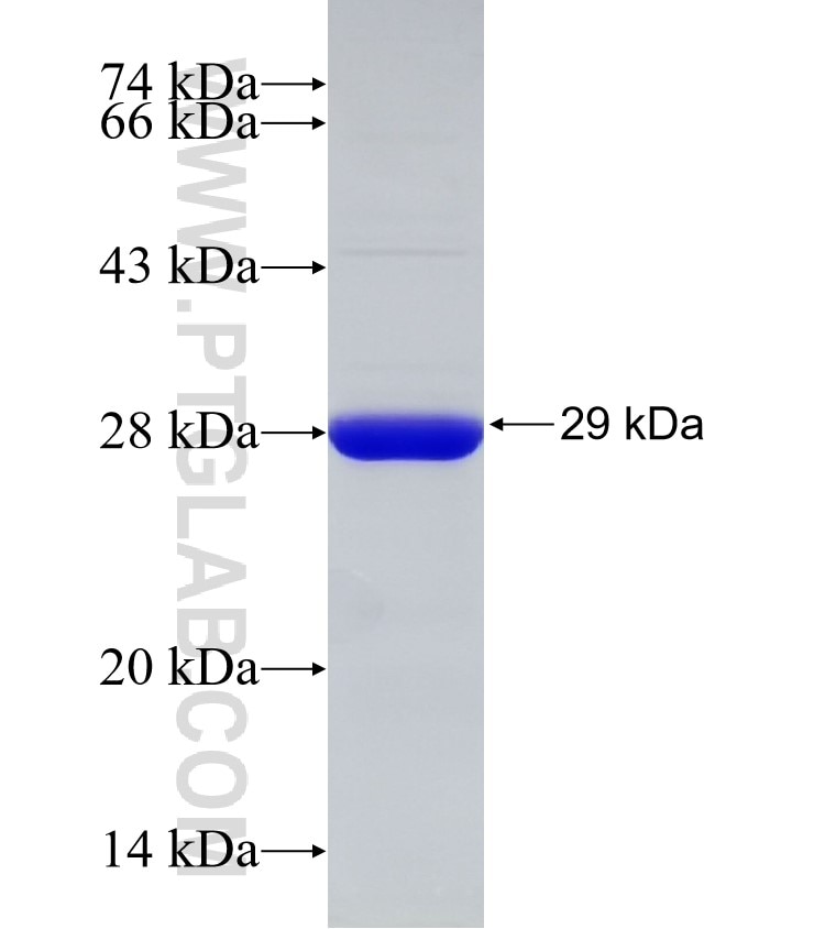 RENALASE fusion protein Ag32675 SDS-PAGE RENALASE fusion protein Ag32675 SDS-PAGE