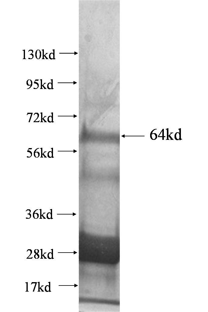 RENALASE fusion protein Ag1323 SDS-PAGE