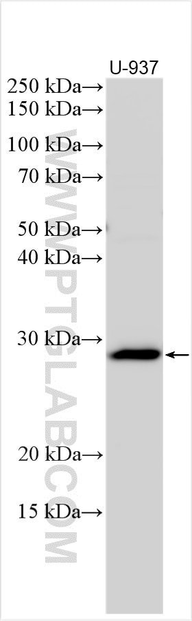 Western Blot (WB) analysis of various lysates using RENBP Polyclonal antibody (31209-1-AP)