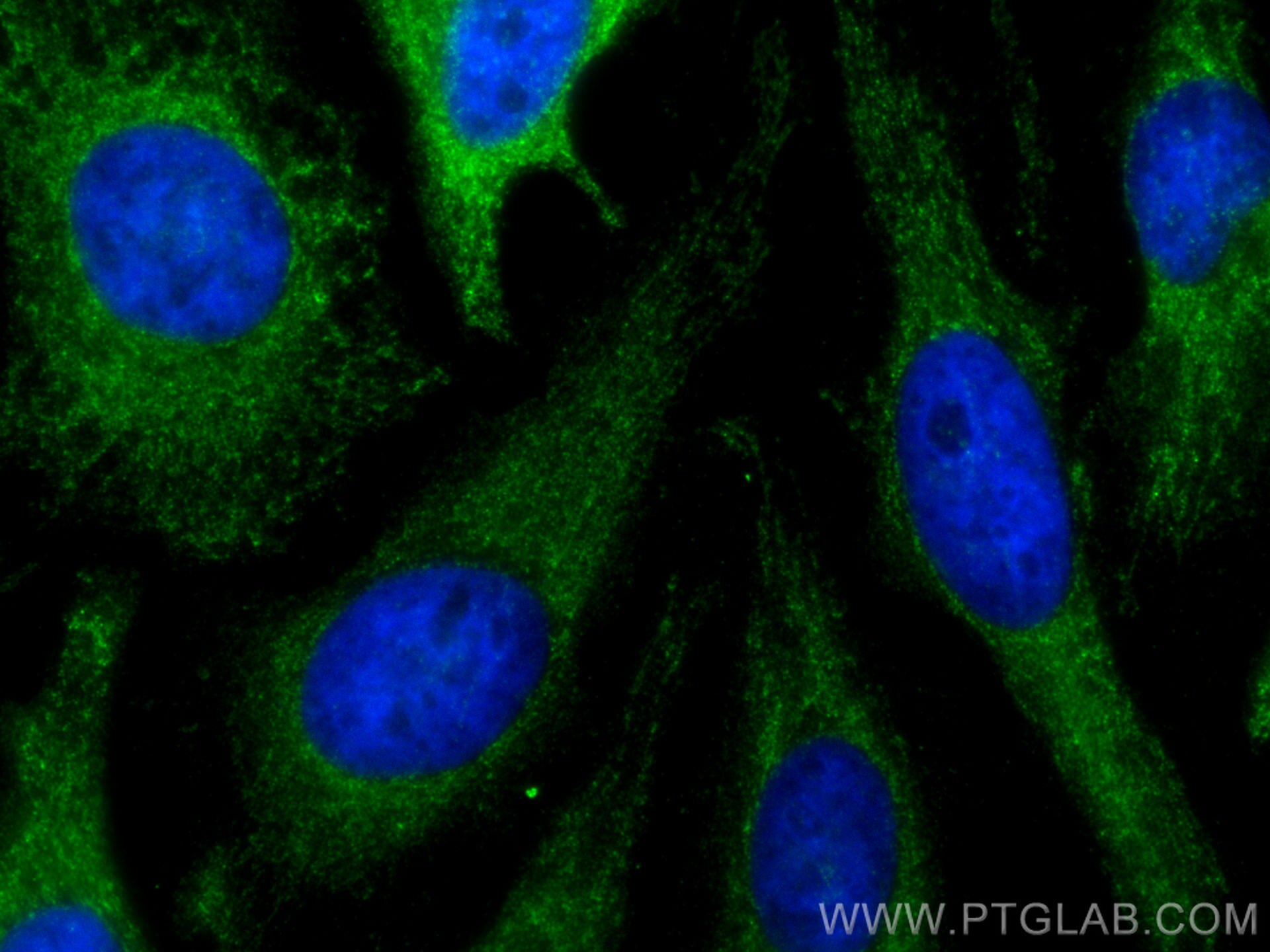 Immunofluorescence (IF) / fluorescent staining of HeLa cells using Renin receptor, ATP6AP2 Polyclonal antibody (10926-1-AP)
