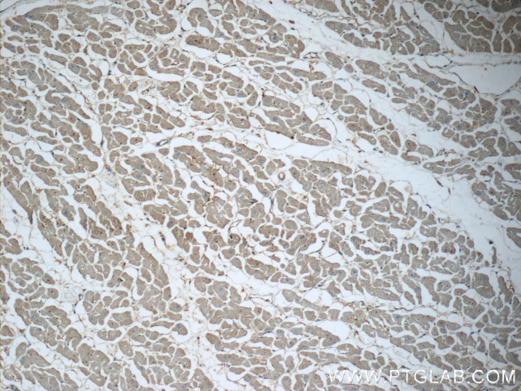 IHC staining of human heart using 10926-1-AP