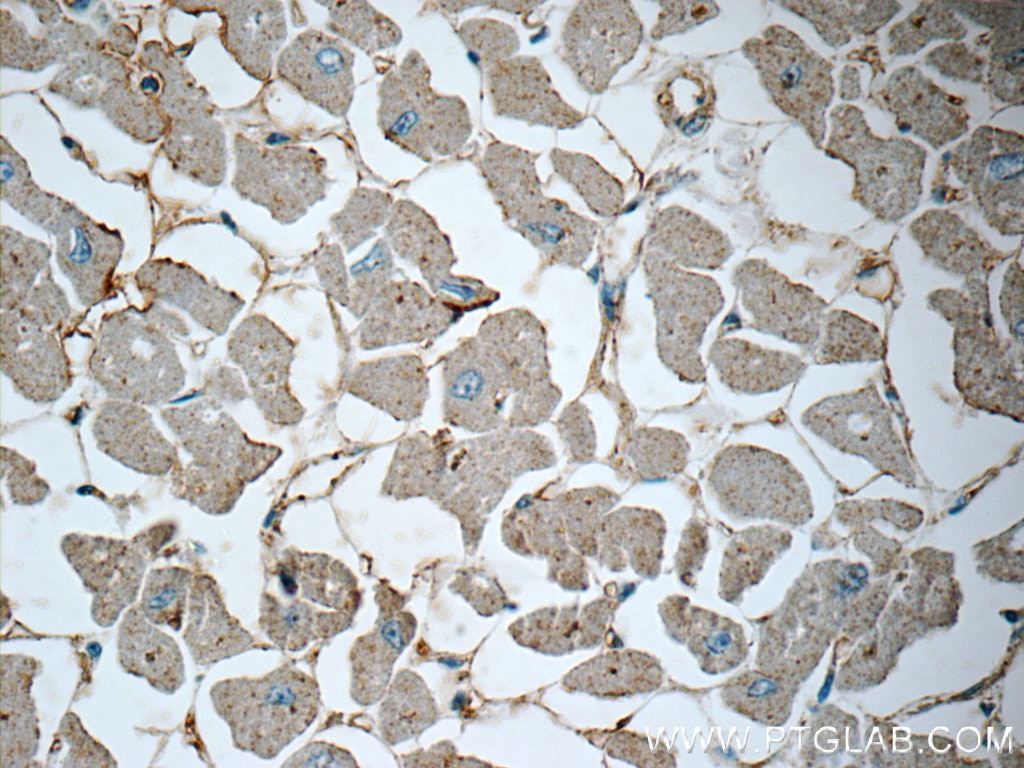 IHC staining of human heart using 10926-1-AP