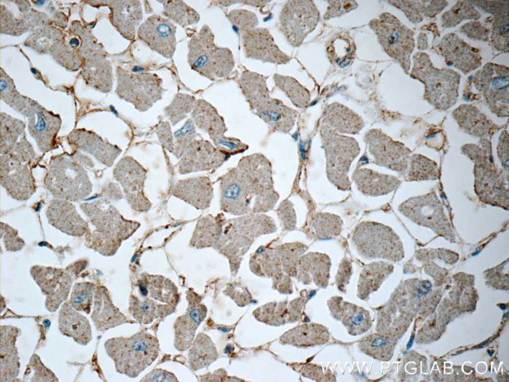 Immunohistochemistry (IHC) staining of human heart tissue using Renin receptor, ATP6AP2 Polyclonal antibody (10926-1-AP)