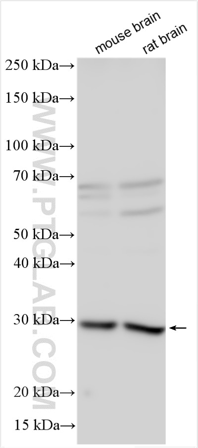 Western Blot (WB) analysis of various lysates using Renin receptor, ATP6AP2 Polyclonal antibody (10926-1-AP)