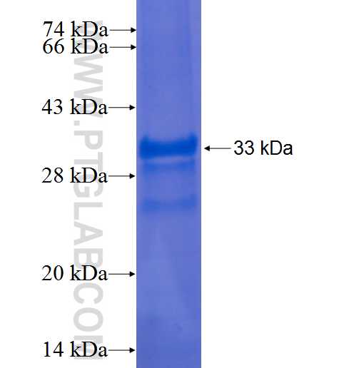 RENIN-RECEPTOR,ATP6AP2 fusion protein Ag1360 SDS-PAGE
