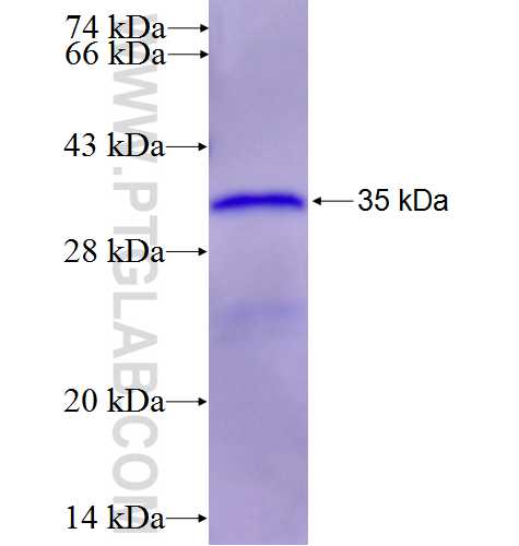 REPIN1 fusion protein Ag6453 SDS-PAGE