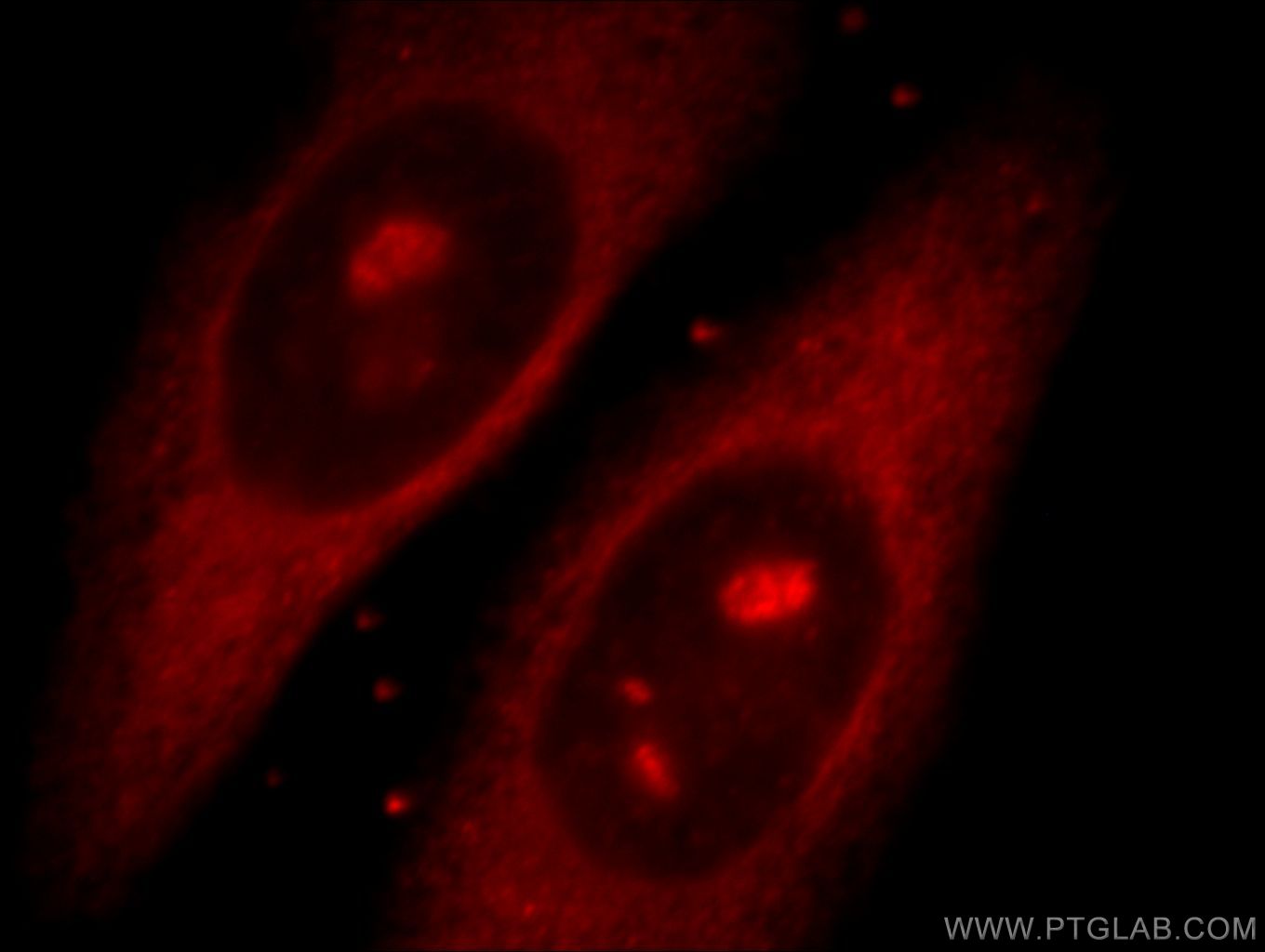 IF Staining of HepG2 using 20699-1-AP