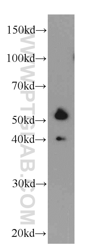 Western Blot (WB) analysis of mouse kidney tissue using REPS2 Polyclonal antibody (20699-1-AP)