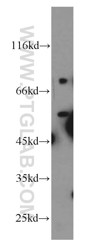 Western Blot (WB) analysis of mouse brain tissue using REPS2 Polyclonal antibody (20699-1-AP)