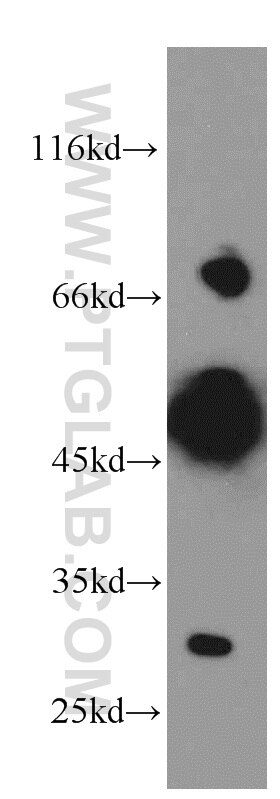 Western Blot (WB) analysis of mouse brain tissue using REPS2 Polyclonal antibody (20699-1-AP)