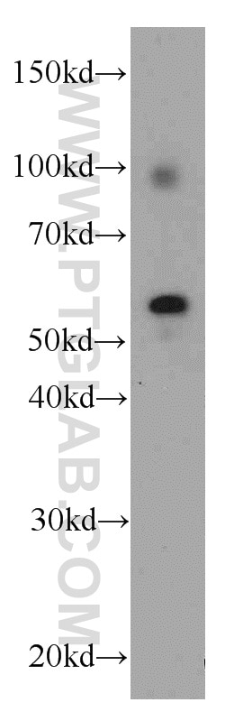 Western Blot (WB) analysis of human testis tissue using REPS2 Polyclonal antibody (20699-1-AP)
