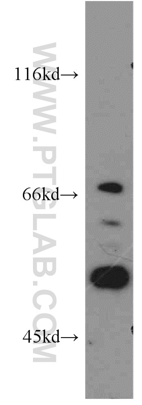 Western Blot (WB) analysis of LNCaP cells using REPS2 Polyclonal antibody (20699-1-AP)