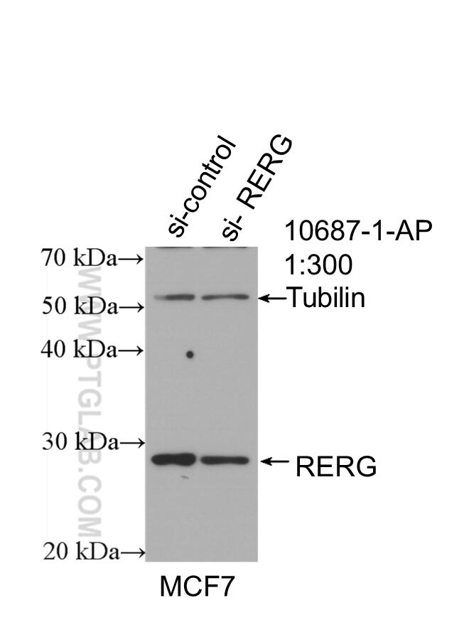 Western Blot (WB) analysis of MCF-7 cells using RERG Polyclonal antibody (10687-1-AP)
