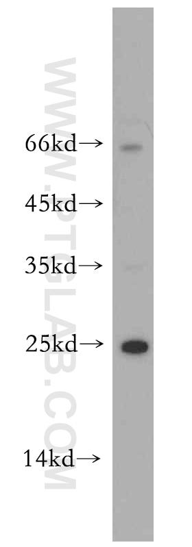 Western Blot (WB) analysis of MCF-7 cells using RERG Polyclonal antibody (10687-1-AP)