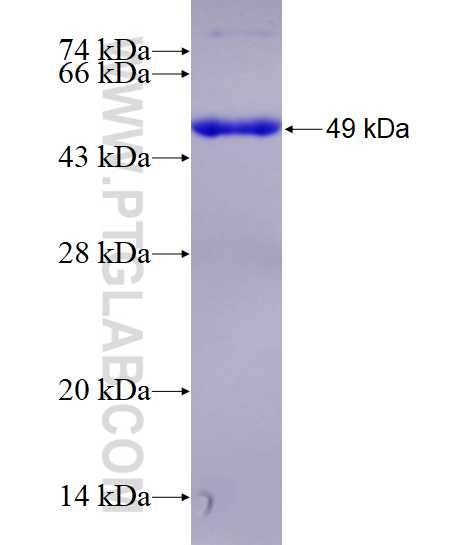 RERG fusion protein Ag1041 SDS-PAGE