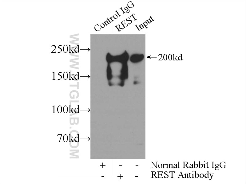 Immunoprecipitation (IP) experiment of HeLa cells using REST Polyclonal antibody (22242-1-AP)