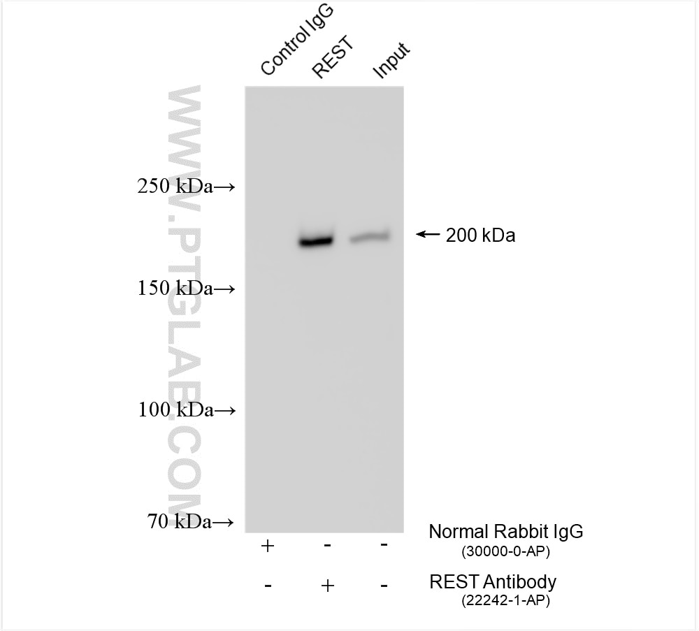 Immunoprecipitation (IP) experiment of HeLa cells using REST Polyclonal antibody (22242-1-AP)