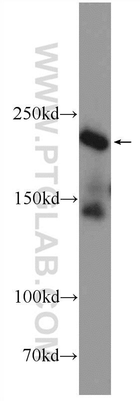 REST Polyclonal antibody