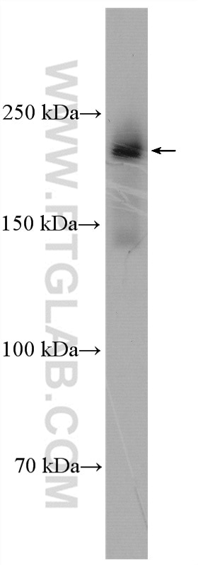 Western Blot (WB) analysis of HEK-293 cells using REST Polyclonal antibody (22242-1-AP)