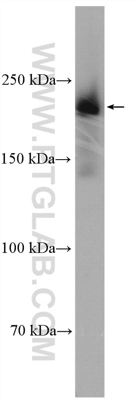 Western Blot (WB) analysis of HEK-293 cells using REST Polyclonal antibody (22242-1-AP)