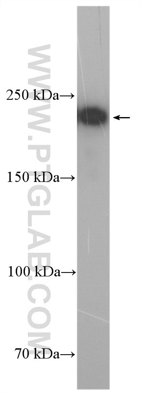 Western Blot (WB) analysis of Raji cells using REST Polyclonal antibody (22242-1-AP)