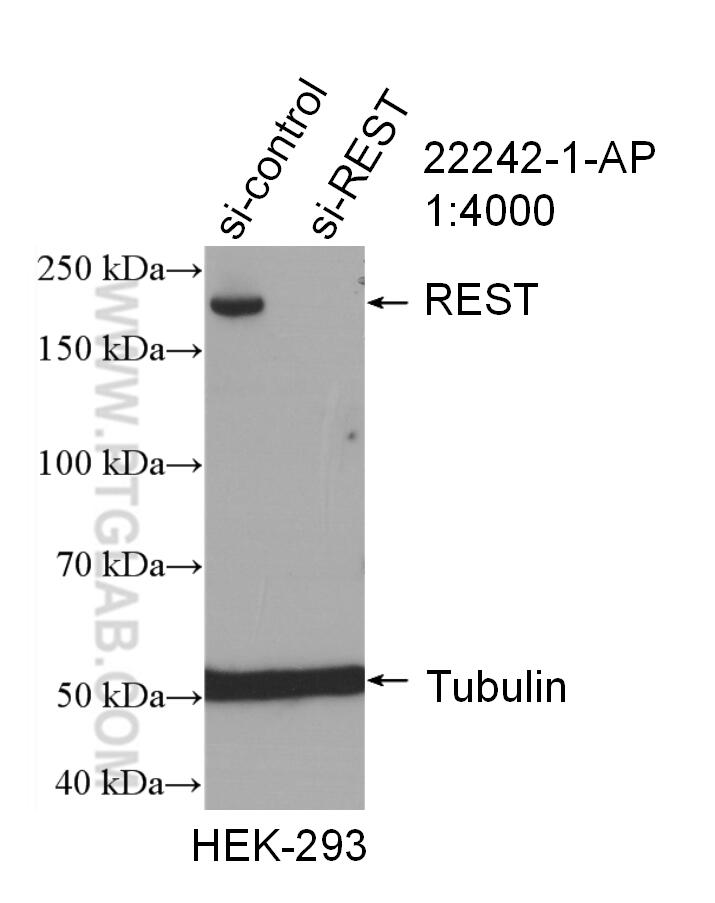 Western Blot (WB) analysis of HEK-293 cells using REST Polyclonal antibody (22242-1-AP)